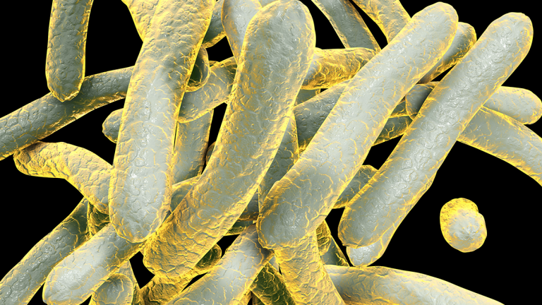 Tuberculosis
